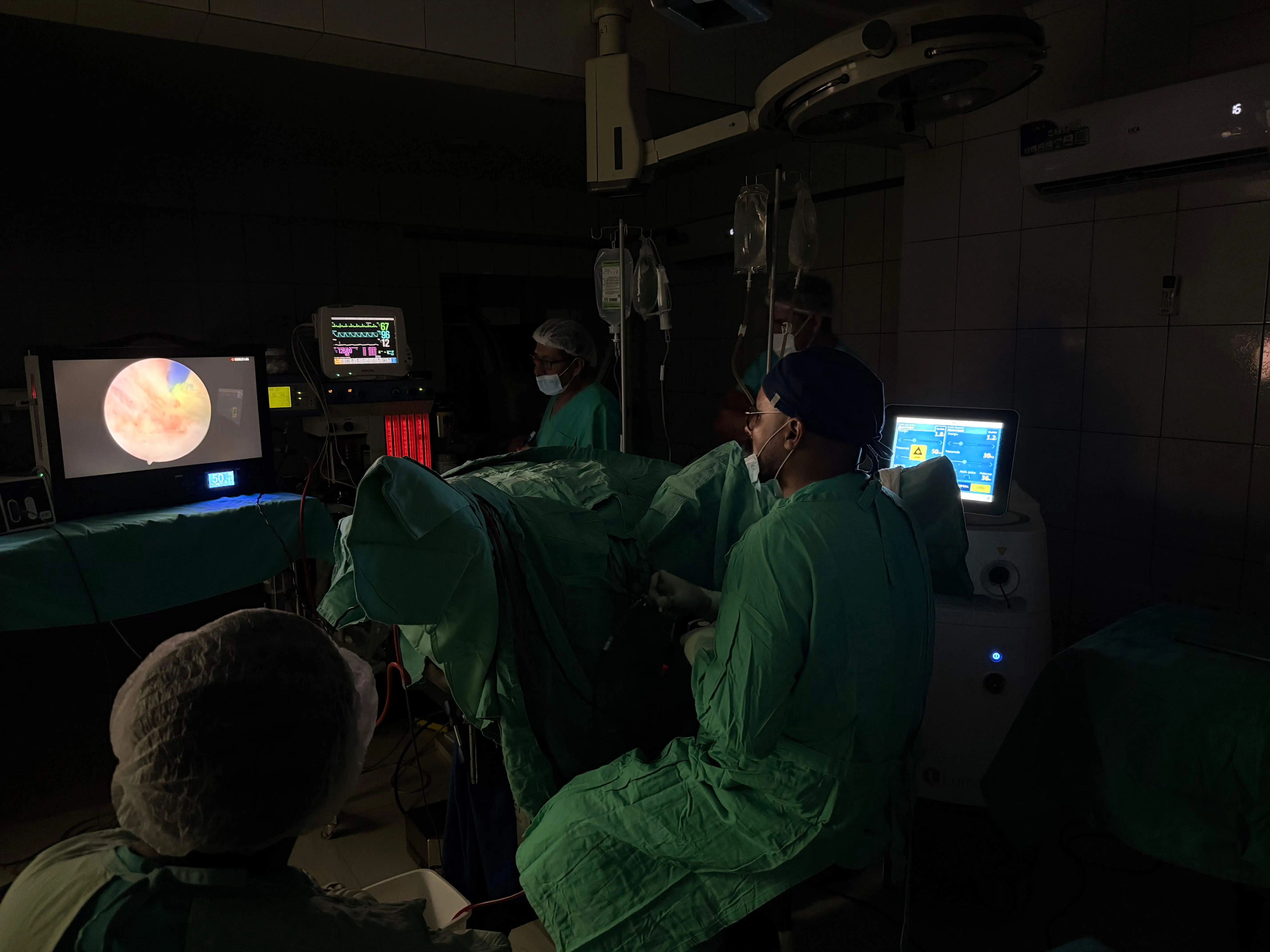 Imagen ilustrativa de tecnología láser para HoLEP