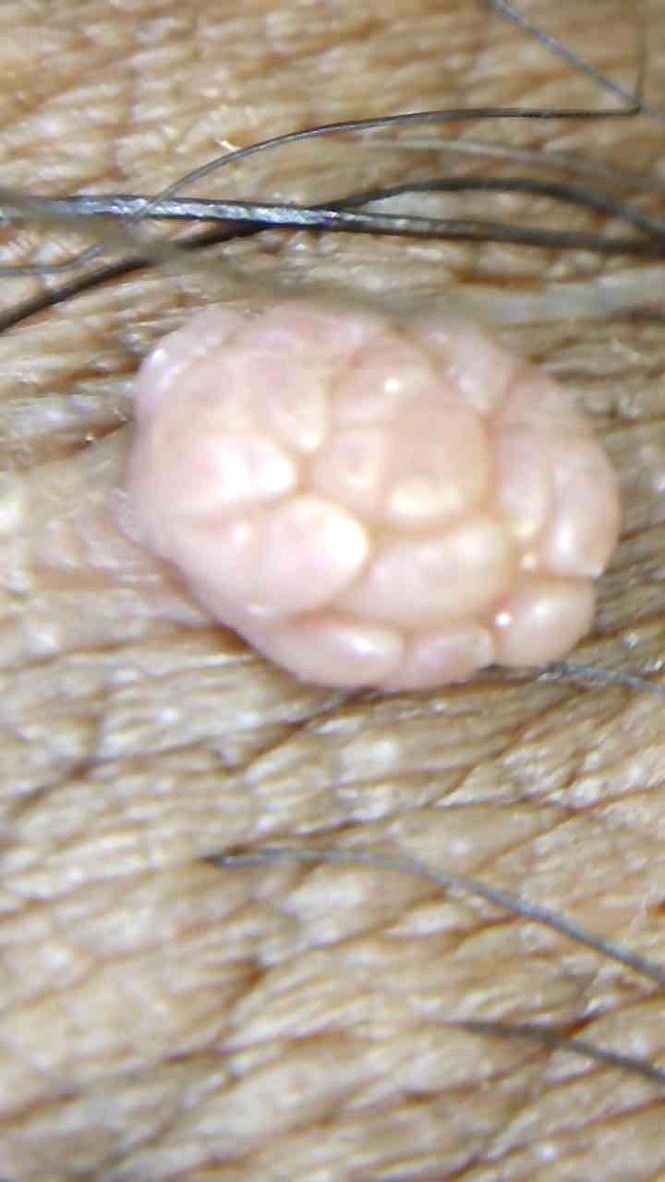 Imagen ilustrativa 2