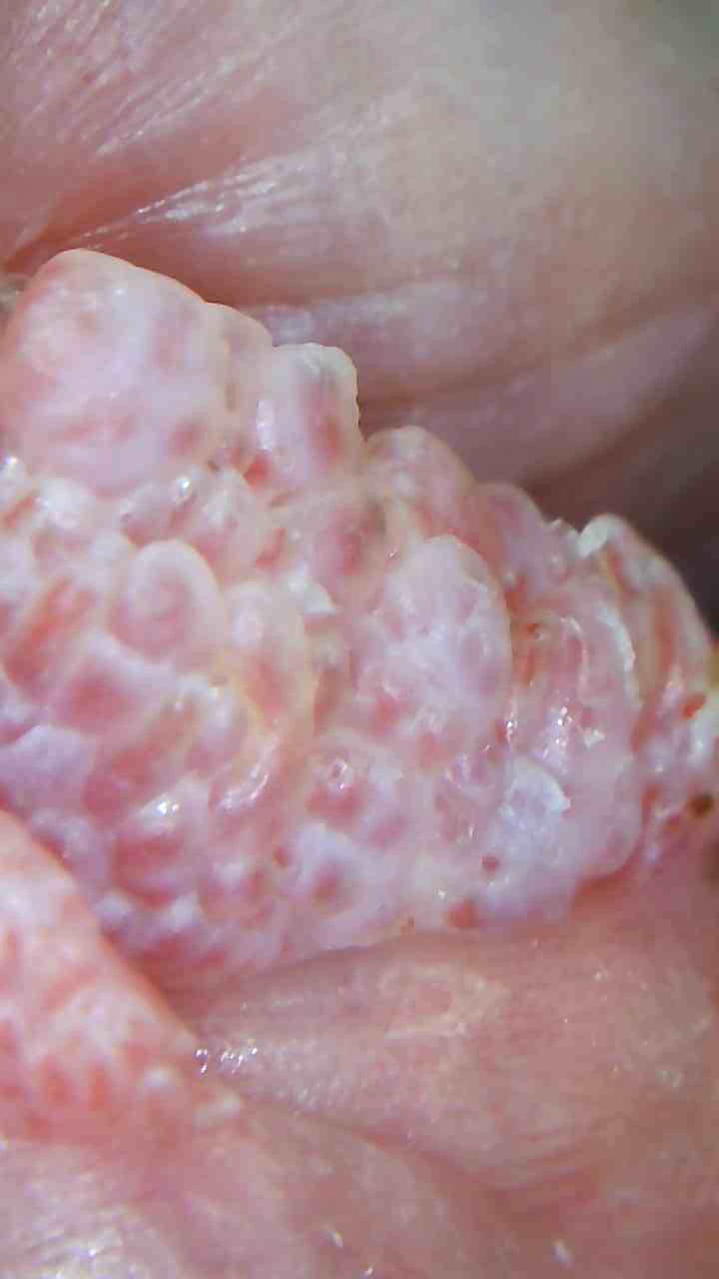 Imagen ilustrativa 4